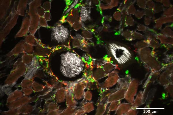 Immunfluorescence of mononuclear phagocytes in the murine kidney | © Barbara Schraml, Stephan Rambichler; LMU Immunfluorescence of mononuclear phagocytes in the murine kidney