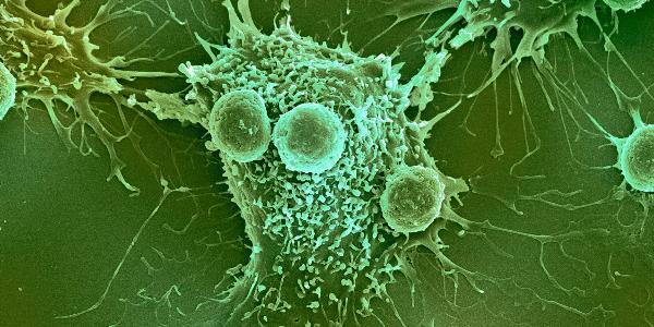 T-Lymphozyten und Krebszelle